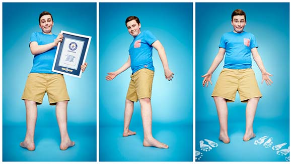 Largest foot rotation thumbnail