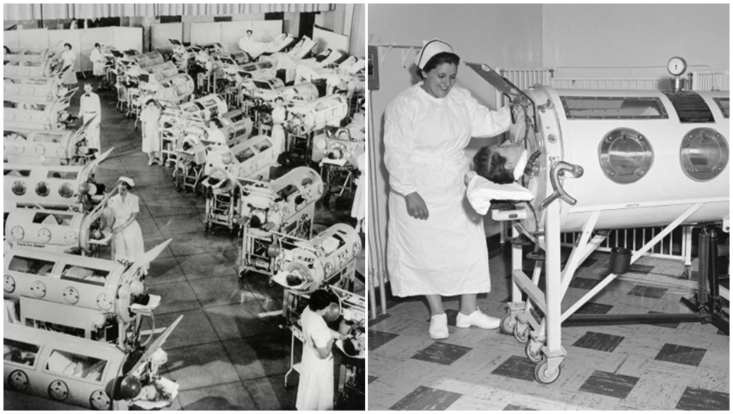 iron lung patients and nurses monochrome split images