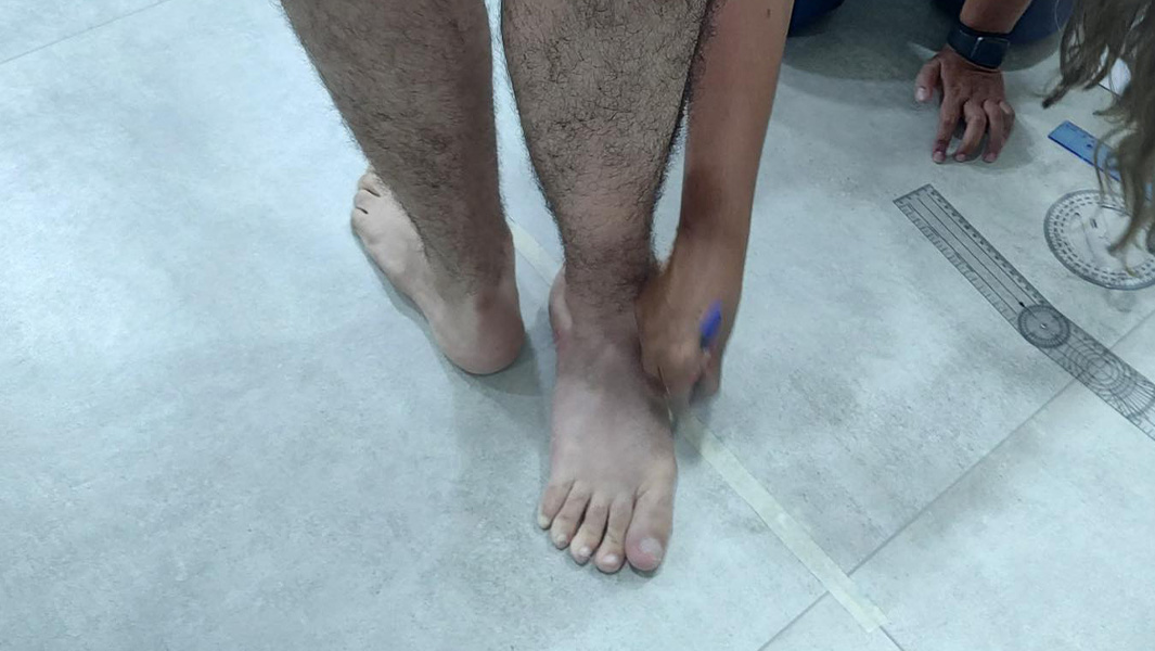 Largest foot rotation being measured